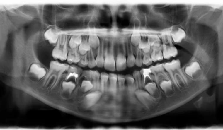 mlijecni zubi,sarajevo,nova dental,stomatolog,stomatolog sarajevo,klinika sarajevo zubar