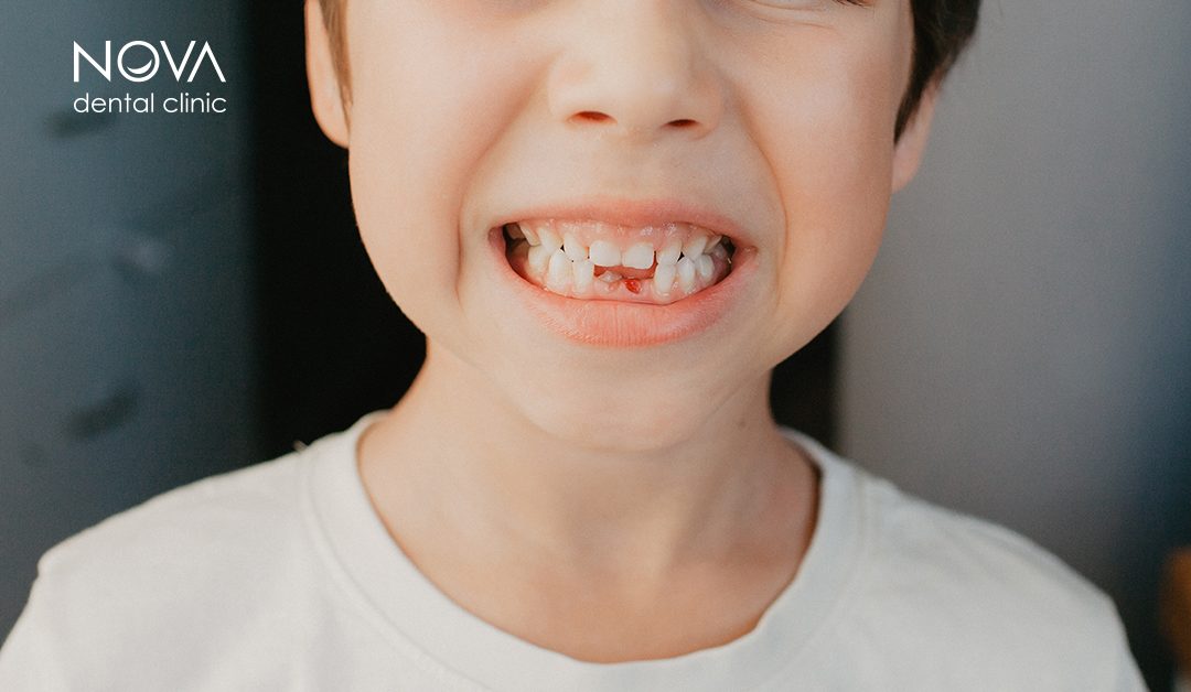 Gdje se nalaze zubi prije nego što izniknu?