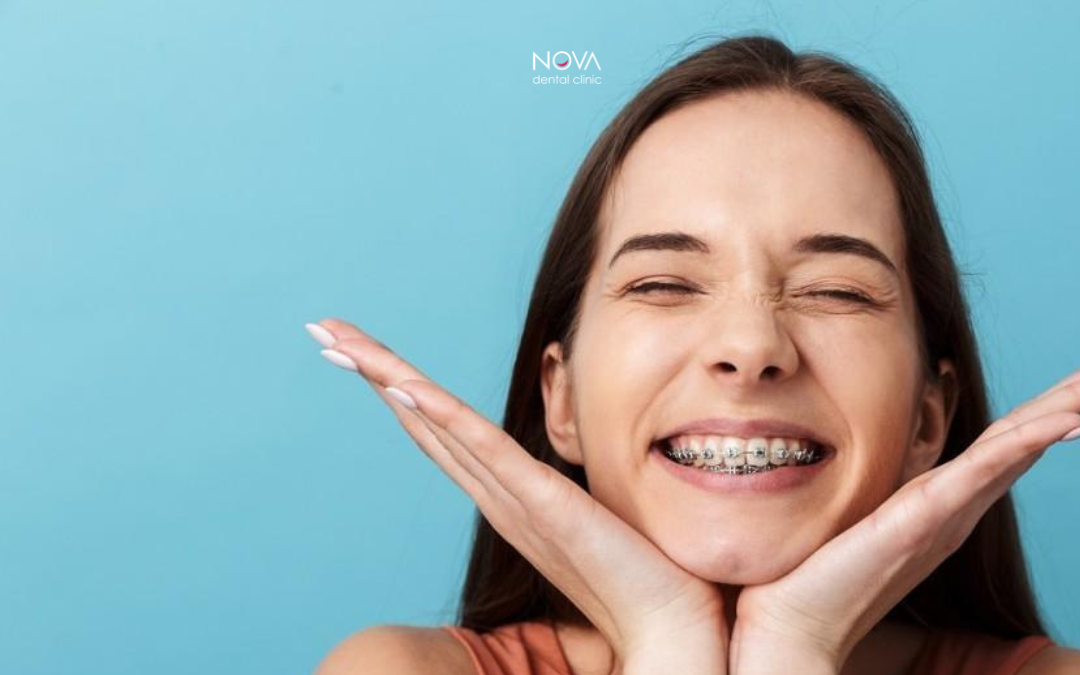 Orthodontic Treatment for Adult Patients: It’s Never Too Late!